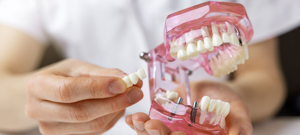 Complete and Partial Dentures treatment service provided by Dr. Sonal Agrawal Best Dentist and Top Dental Specialist at Lotus Dental Care Clinic, Best Dental Clinic in Vashi, Navi Mumbai