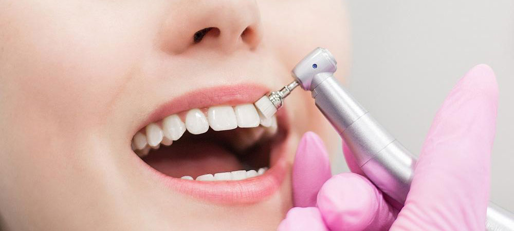 Scaling and Polishing Treatment by Dr. Sonal Agrawal Best Dentist and Top Dental Specialist at Lotus Dental Care Clinic, Best Dental Clinic in Vashi, Navi Mumbai.