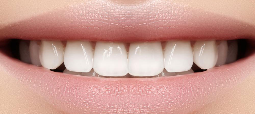 Best Teeth Whitening Treatment by Dr. Sonal Agrawal Best Dentist and Top Dental Specialist at Lotus Dental Care Clinic, Best Dental Clinic in Vashi, Navi Mumbai.